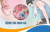 Điều trị sùi mào gà có khó không?