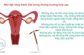 Đặt vòng tránh thai - Phương pháp cứu tinh của phụ nữ