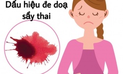 Dấu hiệu đe dọa sẩy thai - Thai phụ cần làm gì?